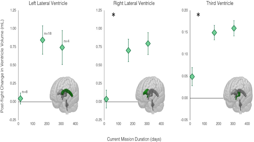 Space travel negatively affects astronauts' brains