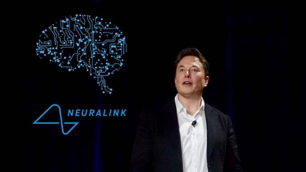 It was revealed how much money Elon Musk collected to insert a chip into the human brain!