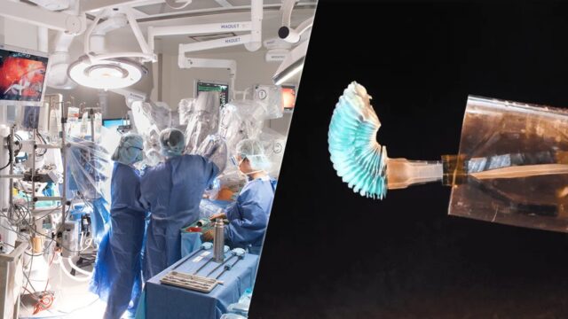 robotic heart surgery, robotic surgery, robotic catheter
