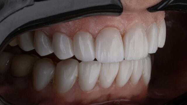 We may start growing new teeth within 5 years!