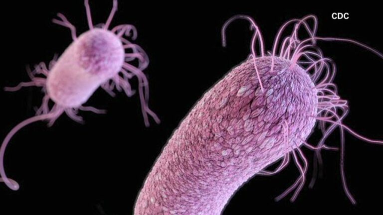 superbug-AI-1