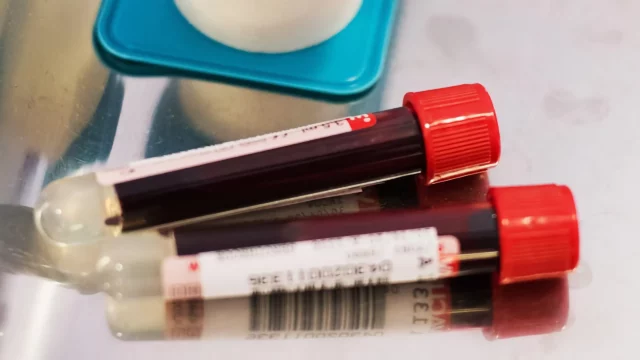 BilliontoOne Investment Reaches $48.5 Million